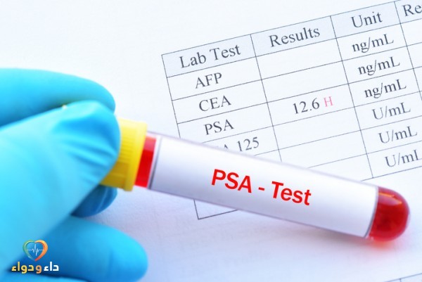 تحليل البروستاتا في الدم PSA