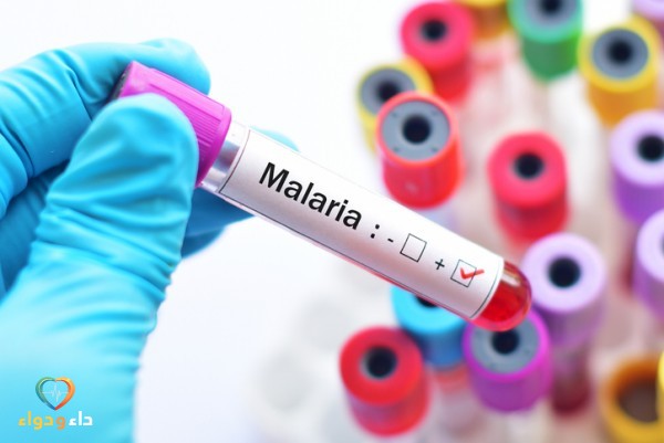 ما هو تحليل الملاريا وكيف يتم إجراؤه