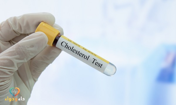 ما هو تحليل الكوليسترول